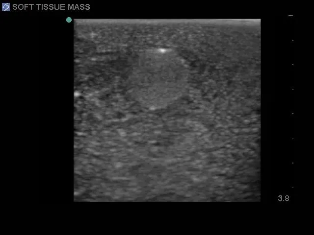 Soft Tissue Biopsy Ultrasound Training Block