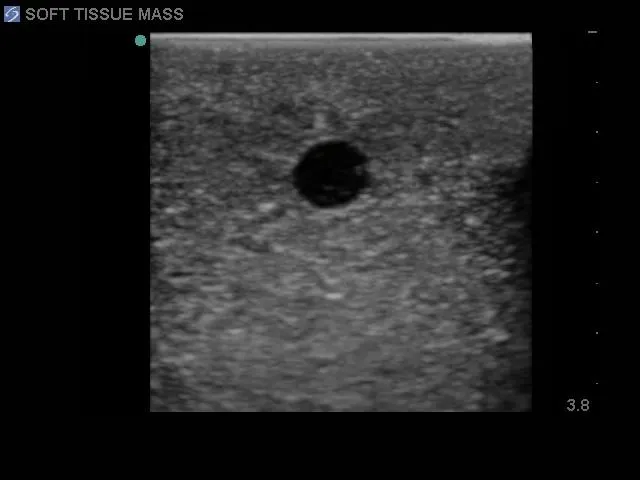 Soft Tissue Biopsy Ultrasound Training Block