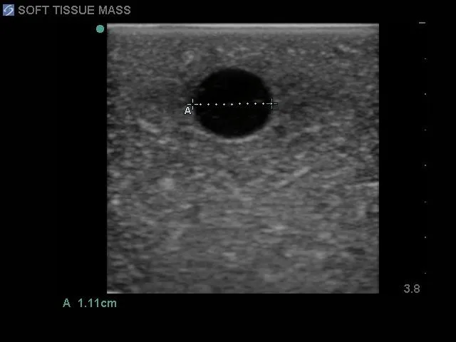 Soft Tissue Biopsy Ultrasound Training Block